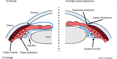 Clarity Eye Clinic - Glaucoma treatment at affordable prices