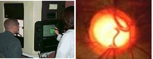 Clarity Eye Clinic - Humphrey Compurerized Field analyzer