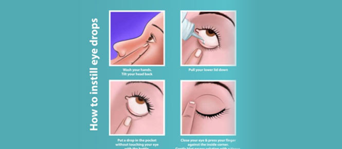 Clarity Eye Clinic - Intraocular Lenses