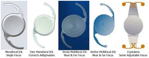 Clarity Eye Clinic - Intraocular Lenses offered