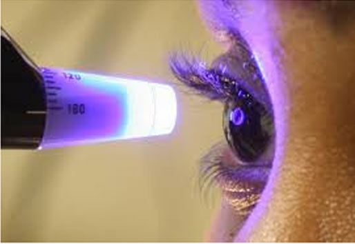 Clarity Eye Clinic - Intraocular services