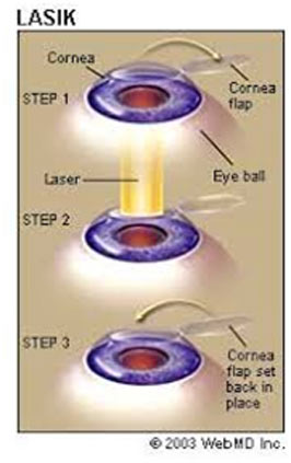 Clarity Eye Clinic - Modern equipments offering utmost eye care services