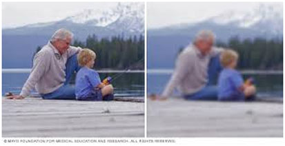 Clarity Eye Clinic - Cataract symptoms