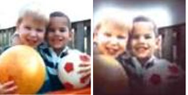 Clarity Eye Clinic - Eye loss symptoms